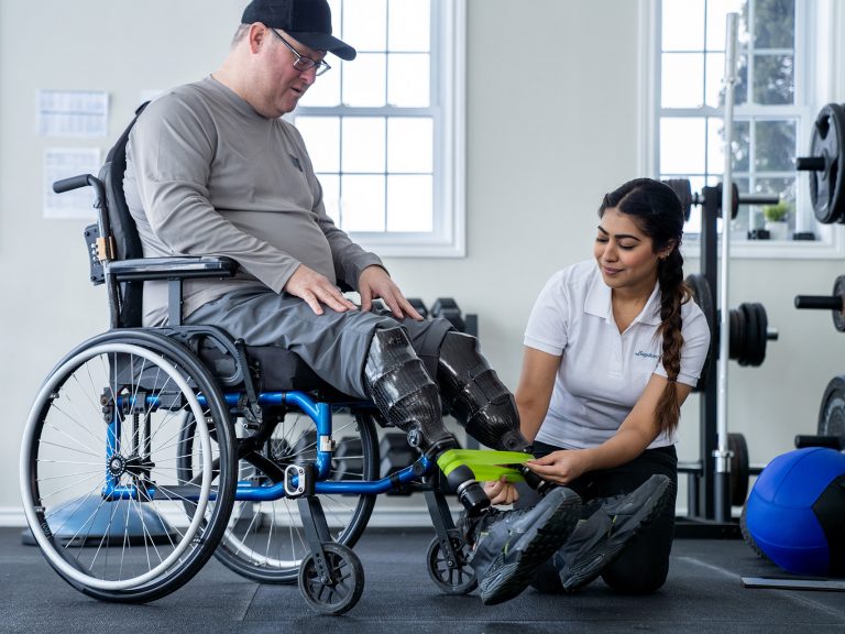 Physiotherapist working with an amputee